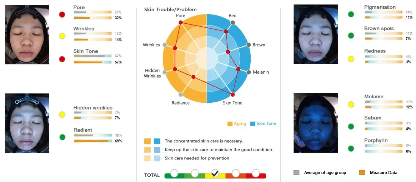 Chart Radiance