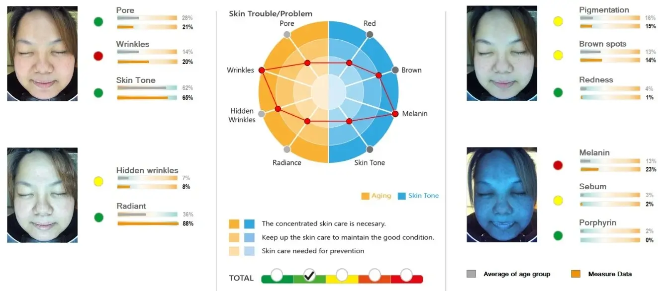 Chart Redness