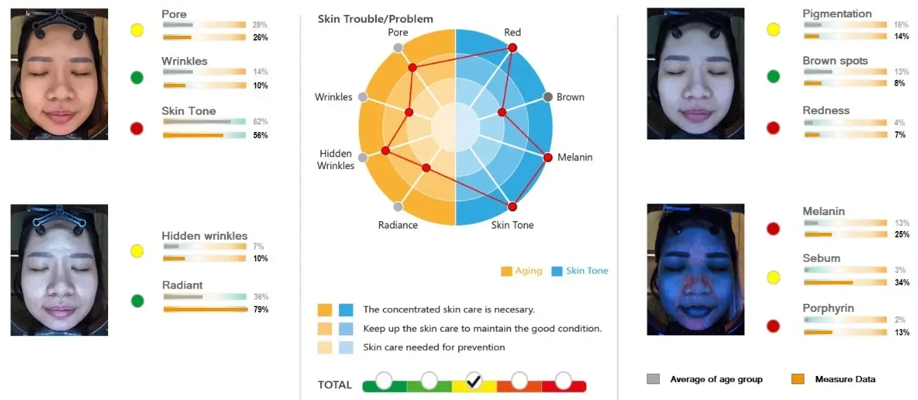 Chart Tone